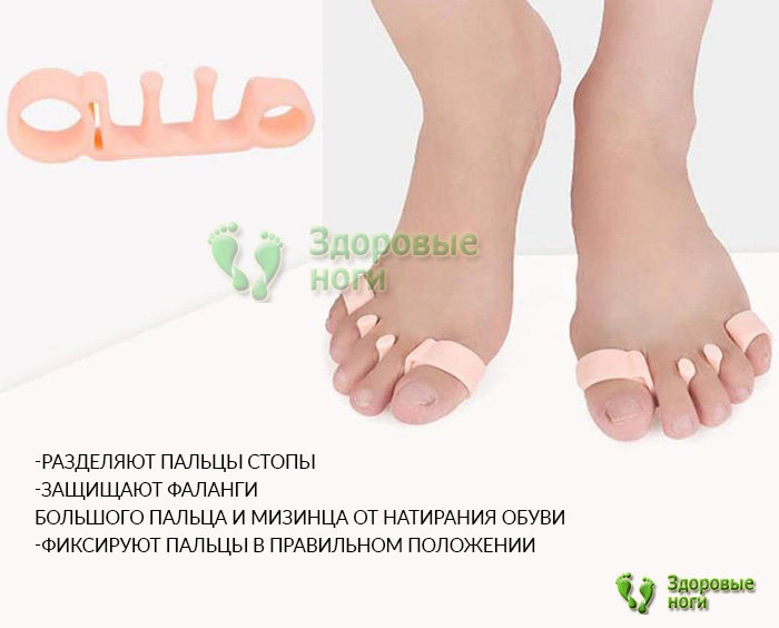 Вы можете купить эластичные силиконовые разделители в интернет-магазине Здоровые Ноги