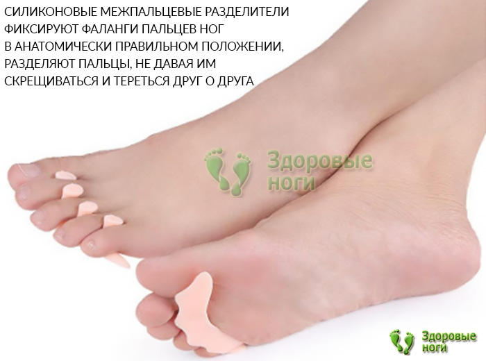Купить разделители для пальцев ног с подплюсневой поддержкой в интернет-магазине Здоровые Ноги