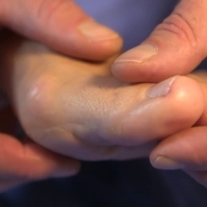 Массаж пальцев ног для лечения