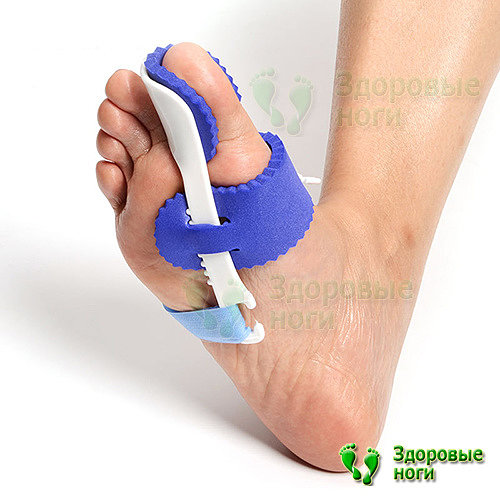 Эффективное лечение шишки на пальцах ног возможно, благодаря ночному бандажу