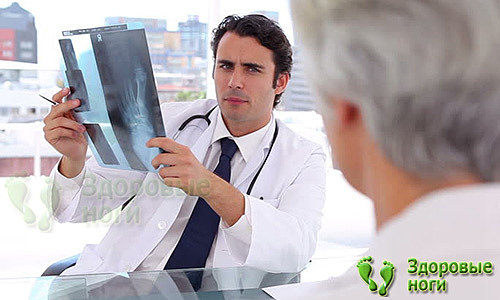 Описание рентгеновского снимка на предмет пяточной шпоры проводит врач-рентгенолог