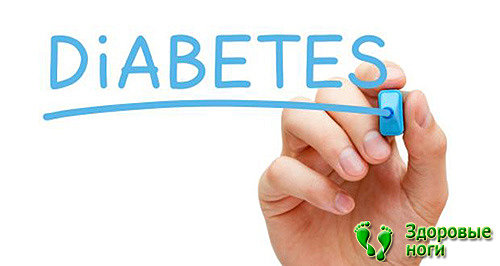 Ваша информированность поможет увеличить эффективность лечения диабетической стопы