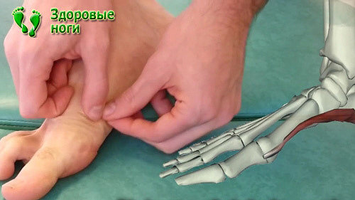 Массаж шишки большого пальца ноги