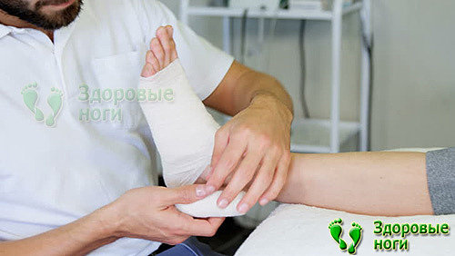 При сахарном диабете раны на пальцах ног необходимо промывать и перевязывать