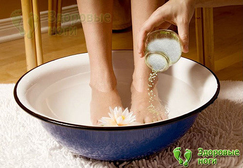 При пяточной шпоре ванночки для ног с солью помогут снять боль и снизить воспаление