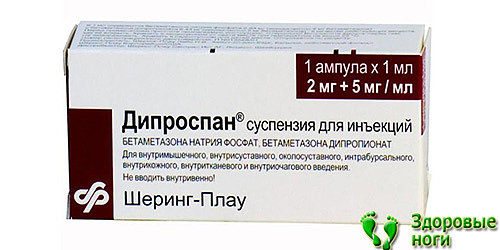 Среди лекарств для лечения пяточных шпор также выделяют Дипроспан, применяемый для инъекций и в виде мази