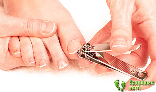 При диабетической стопе важна правильная обработка ногтей