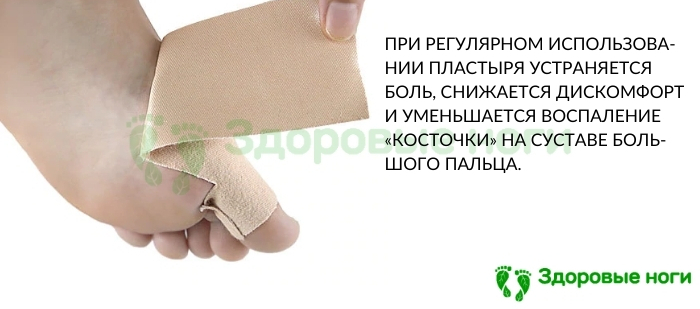 Пластырь-наклейка для защиты вальгусной косточки от натирания