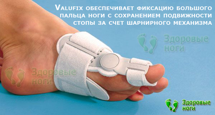 Шарнирная вальгусная шина Валюфикс (Valufix) - купить ортопедический ...