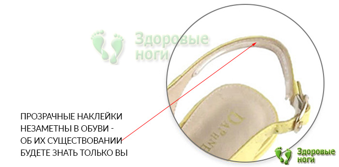 Отзывы на комплект наклеек из силикогеля для обуви говорят о его эффективности