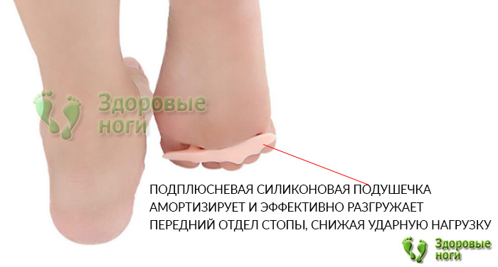 Ортопедический разделитель для пальцев ног с поддержкой плюсны корректирует деформацию пальцев