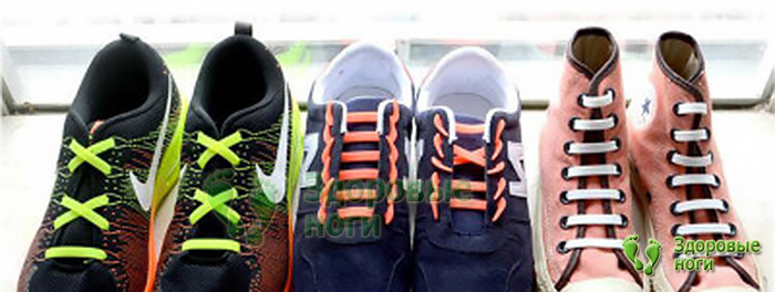 Купить силиконовые шнурки с фиксатором в интернет-магазине Здоровые Ноги