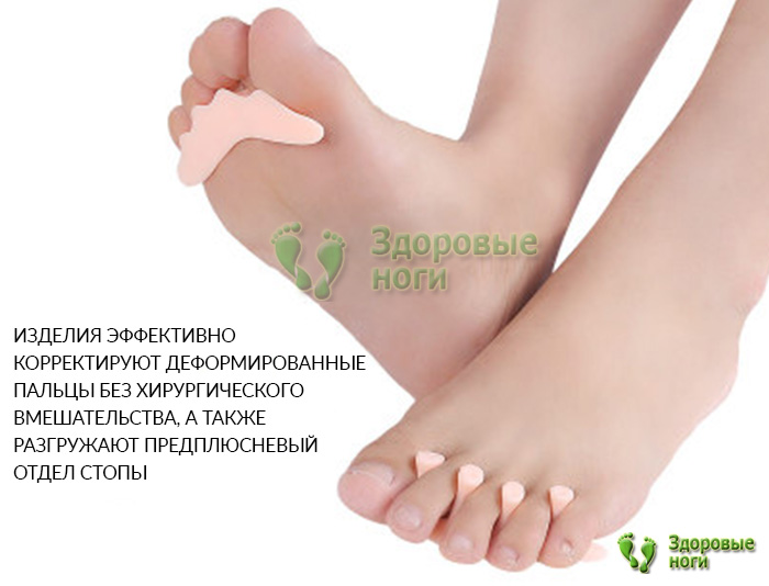 Ортопедический разделитель для пальцев ног с поддержкой плюсны снимает болевые ощущения и дискомфорт
