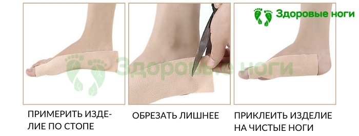 Наклейка для защиты косточек на ногах и сустава большого пальца от натирания