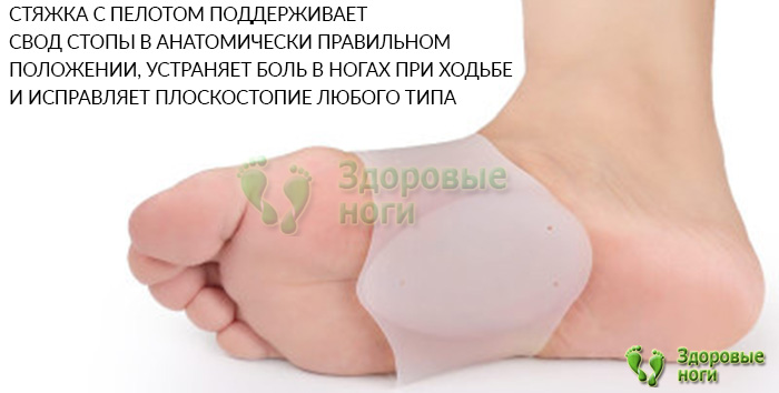Купить силиконовые стяжки для стопы при плоскостопии в интернет-магазине Здоровые Ноги по низкой цене