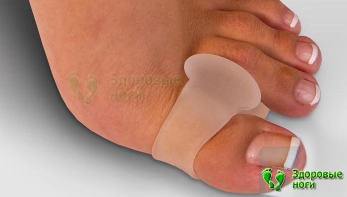 Для большого пальца ноги силиконовый корректор применяется для фиксации сустава