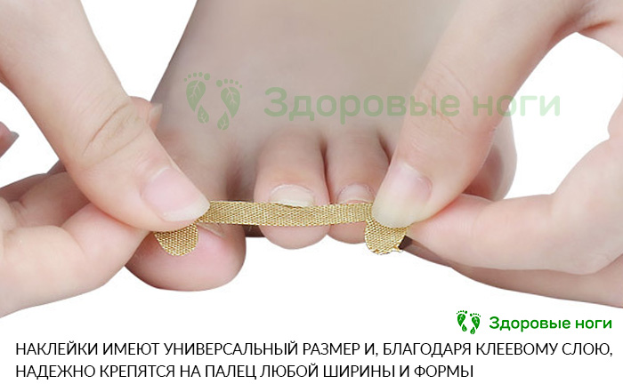 Патчи для коррекции ногтей на первых этапах врастания имеют универсальный размер
