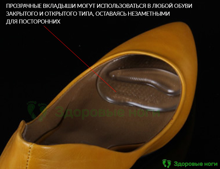 Отзывы на силиконовые вкладыши для обуви на высоком каблуке с подушечкой под пальцы говорят об их эффективности