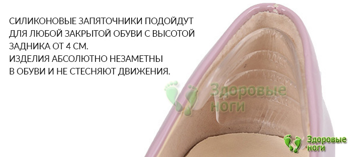 Запяточники с ребристой поверхностью на задник обуви снимают боль и дискомфорт с пяточной области