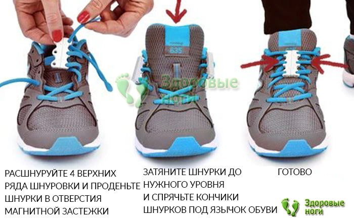 Застежки для обуви с магнитами неприхотливы в уходе