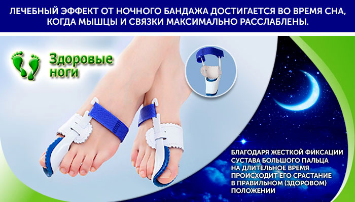 Ночной бандаж Hav Splint в составе комплекта для лечения косточек на ноге