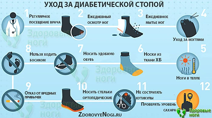 Алгоритм ухода за диабетической стопой