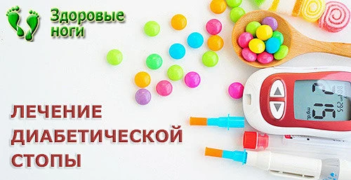 На начальных стадиях применяется консервативное лечение диабетической стопы