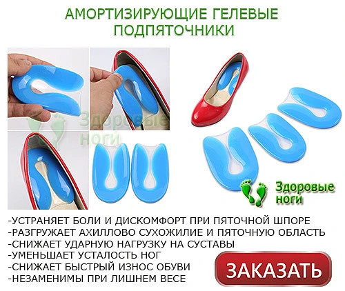 Гелевые ортопедические подпяточники при пяточной шпоре являются самыми доступными и популярными