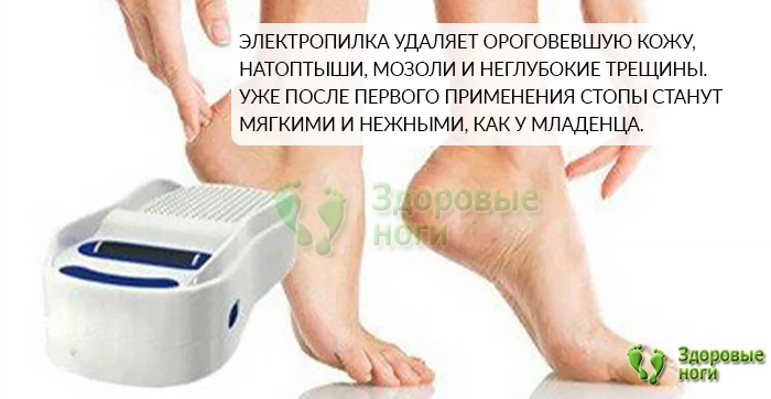 Роликовая пилка для педикюра сделает стопы мягкими и нежными