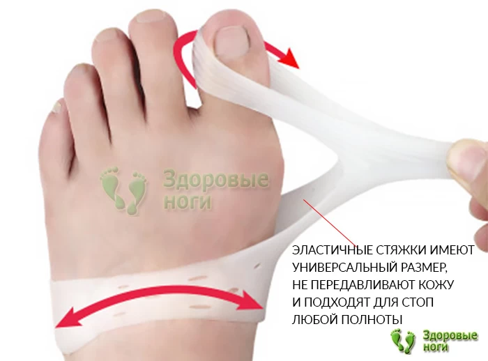 Силиконовый корректор с фиксацией от косточки на большом пальце ноги подходит для стоп любого размера и полноты