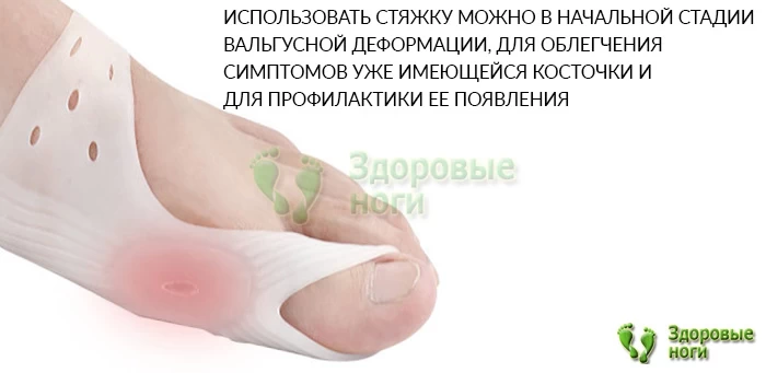 Силиконовый корректор большого пальца ноги с фиксацией устраняет боль и усталость при ходьбе