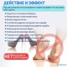 Комплект для комфортного ношения обуви на высоких каблуках ORTGUT HIGH HEEL