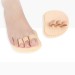 Комплект при молоткообразной деформации пальцев ног «ORTGUT HAMMERTOE»