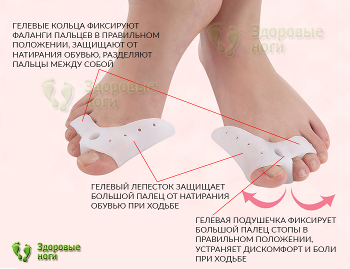 В нашем интернет-магазине вы можете купить буропротектор при молоткообразной деформации В нашем интернет-магазине вы можете купить буропротектор при молоткообразной деформации