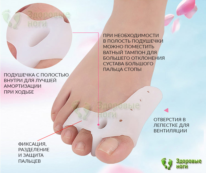 Цена на бурсопротектор при молоткообразных пальцах доступна для любого кошелька Цена на бурсопротектор при молоткообразных пальцах доступна для любого кошелька