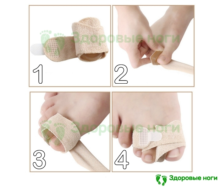 Подушечка при "косточке" на большом пальце Подушечка при "косточке" на большом пальце