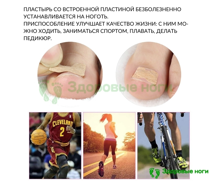 Универсальный пластырь для вросших ногтей Универсальный пластырь для вросших ногтей