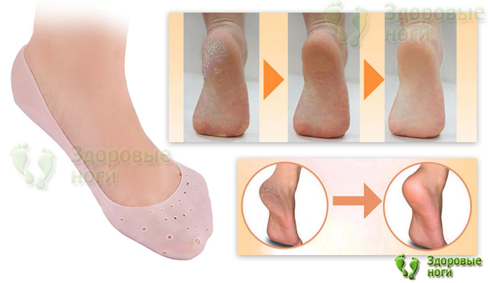 Вы можете заказать силиконовые носочки для ног с доставкой по всей России Вы можете заказать силиконовые носочки для ног с доставкой по всей России