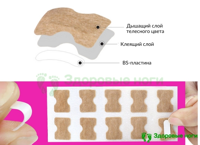 Отзывы о пластыре для исправления вросших ногтей Отзывы о пластыре для исправления вросших ногтей
