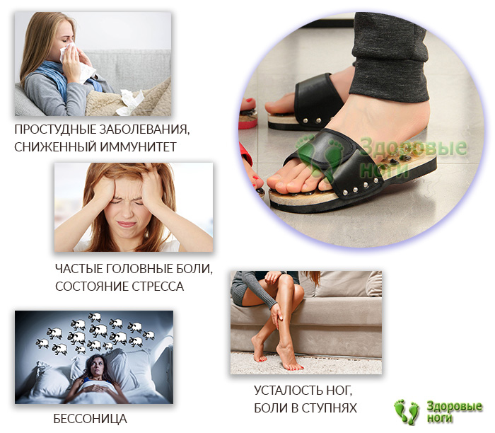 Отзывы о шлепках с камнями говорят об их эффективности Отзывы о шлепках с камнями говорят об их эффективности