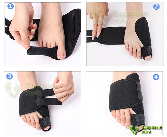 Вальгусная шина тканевая крайне проста в использовании Вальгусная шина тканевая крайне проста в использовании