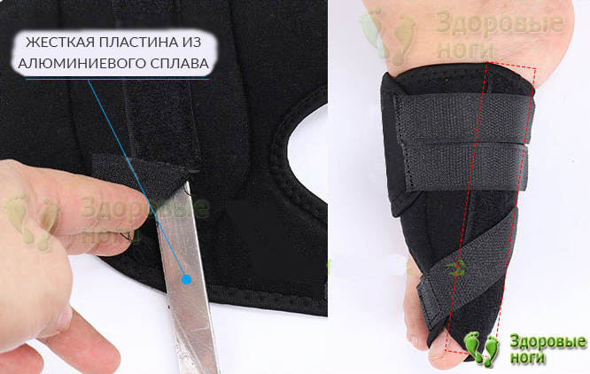 Внутри тканевой шины находится металлическая пластина для жесткой фиксации сустава Внутри тканевой шины находится металлическая пластина для жесткой фиксации сустава